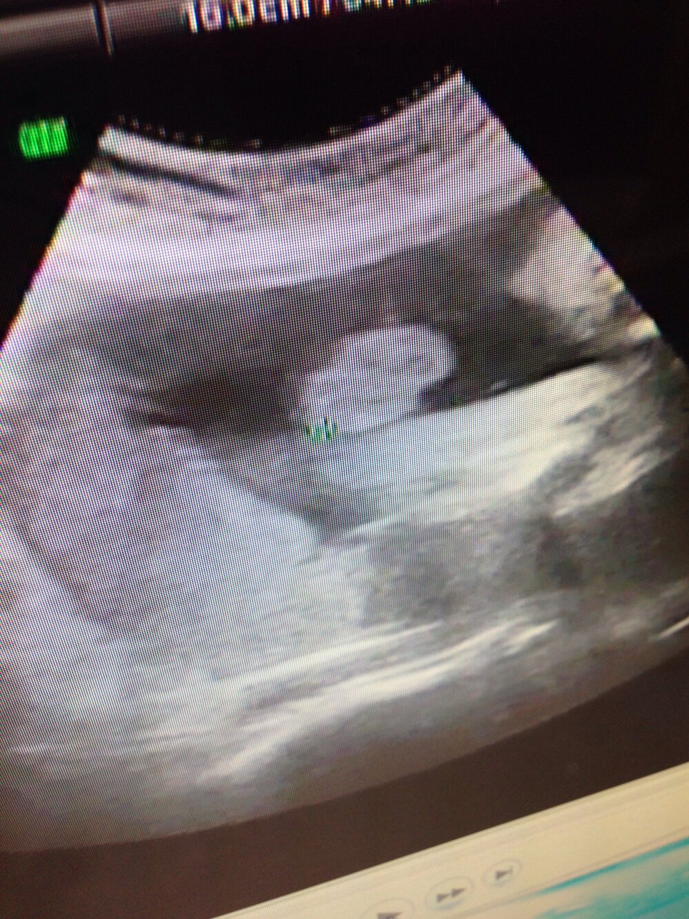 妊娠26wのエコーになります あしとあしの間に丸いものがあるような 性別 Yahoo 知恵袋