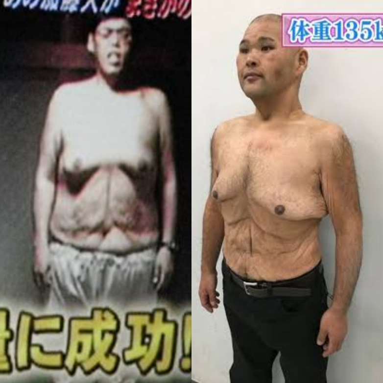 ダイエット 皮余り 画像 ダイエット 皮余り 画像