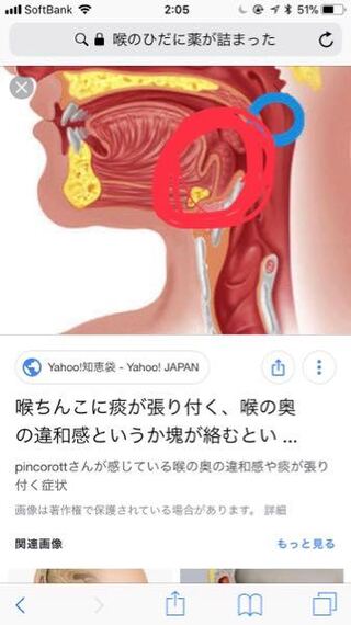 薬 が 喉 に 引っかかっ た 病院 Englshyufi