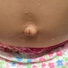 この女の子のお臍は見事に出ていますか 出べそですか でべそで Yahoo 知恵袋