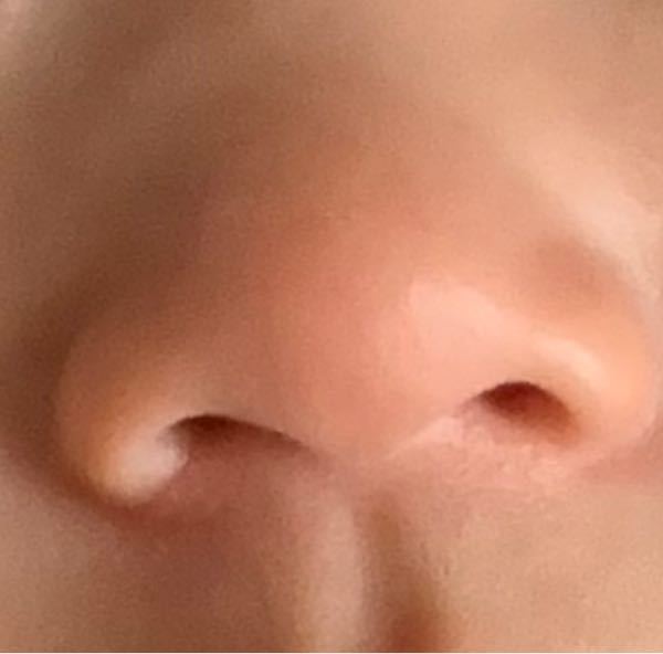 生後3ヶ月です 下から見た写真なのですが将来は団子鼻とか豚鼻になりますで Yahoo 知恵袋