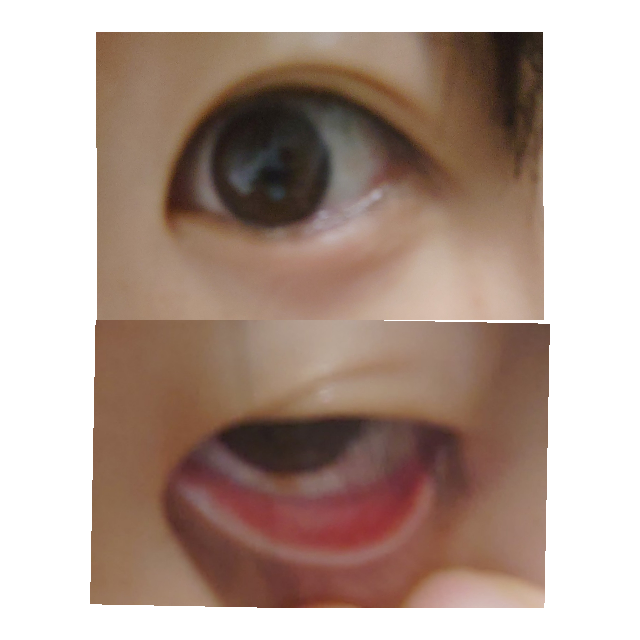 左目の下まぶたが腫れており 明日眼科に行く予定ですが 結膜炎でしょ Yahoo 知恵袋