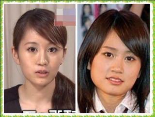 前田敦子がエラを削った時期はいつですか エラを削った後はかなり Yahoo 知恵袋