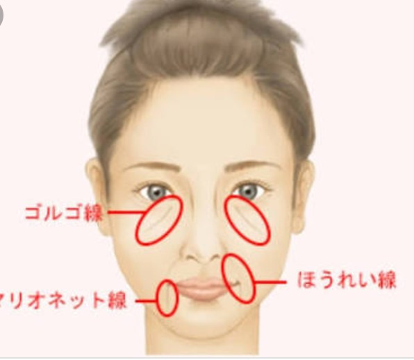 ブルドッグラインとほうれい線の違いは何ですか 調べてみると同じ場所を指している Yahoo 知恵袋