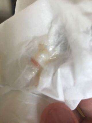 汚いと思いますがすみません この質問は知恵袋何回もして解決したはずな Yahoo 知恵袋