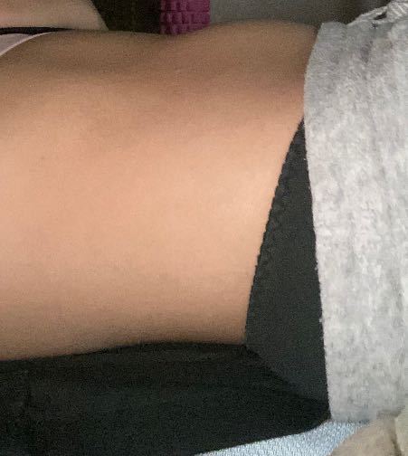 コイン100枚です 至急なのでお願いします 卵巣腫瘍お腹ぽっこり画像汚く Yahoo 知恵袋