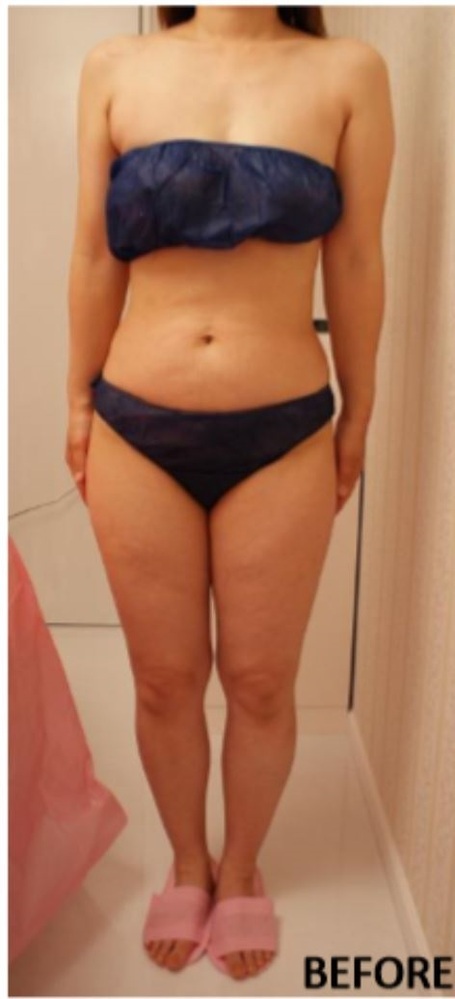 26歳女で身長157cm 体重54kg 体脂肪率27 骨格筋率28 は普通と Yahoo 知恵袋