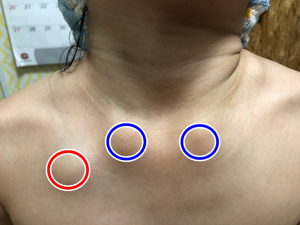7歳の娘なのですが 朝から微熱があり学校を休ませて様子を見ていましたが先程お風 Yahoo 知恵袋