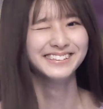 メチャクチャ可愛いですよね でも 歯並びが気になりませんか 歯並びは矯正 Yahoo 知恵袋